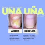 reparador uñas