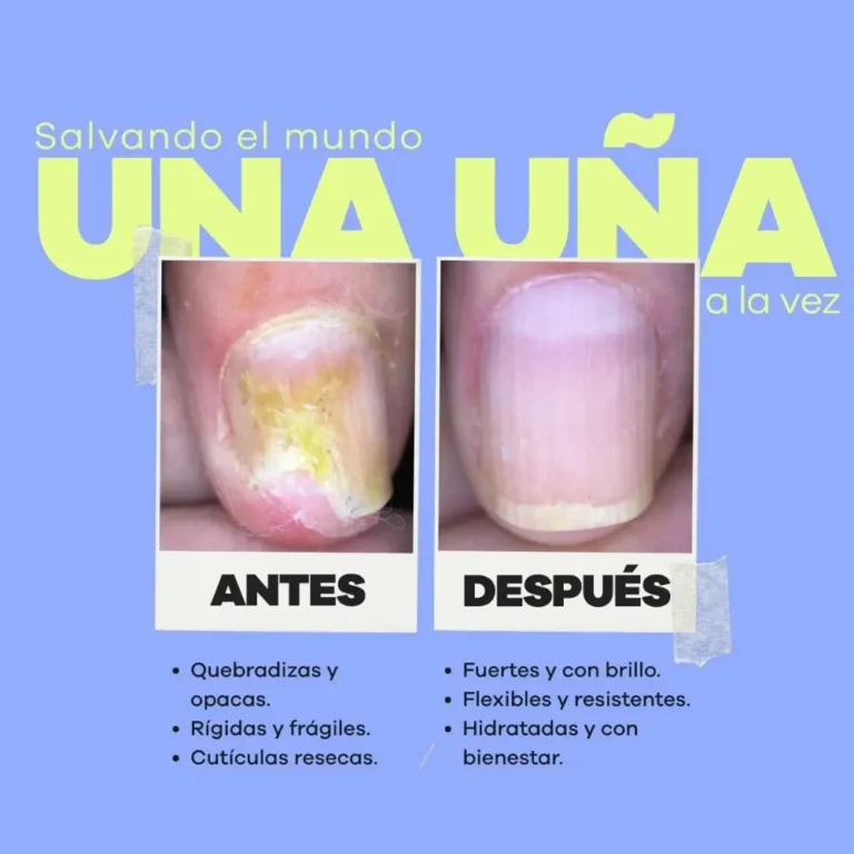 reparador uñas